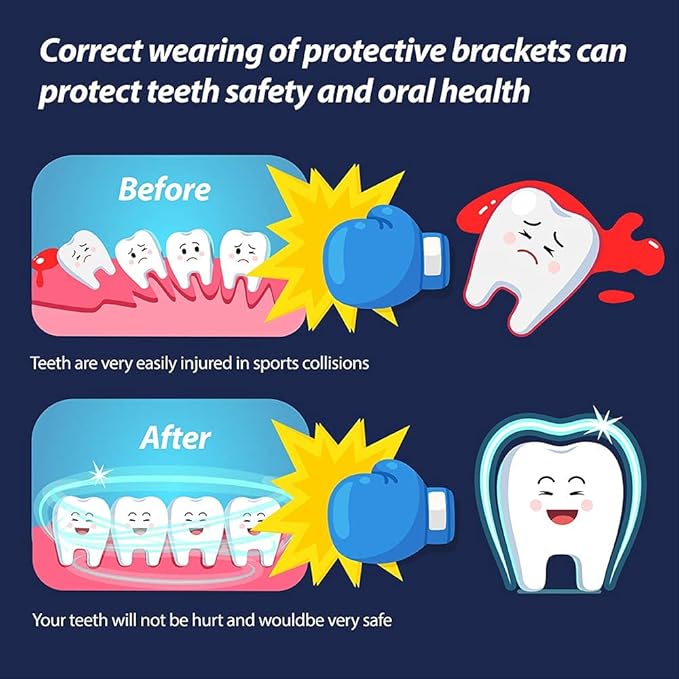 Youth Mouth Guard Football Sport Mouthguard, Premium Quality No Boiling Required，Suitable for Basketball, Wrestling, Taekwondo, Jujitsu and Karate