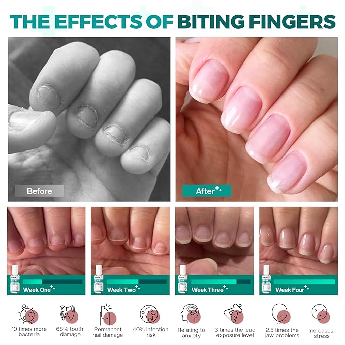 Morovan Nail Biting Prevention For Kids: Thumb Sucking Deterrent Stop Nail Biting Treatment Adults No Bite Nail Polish for Biters Anti Finger Sucking Lasting & Safe with Repair and Healthy Nails 15ML