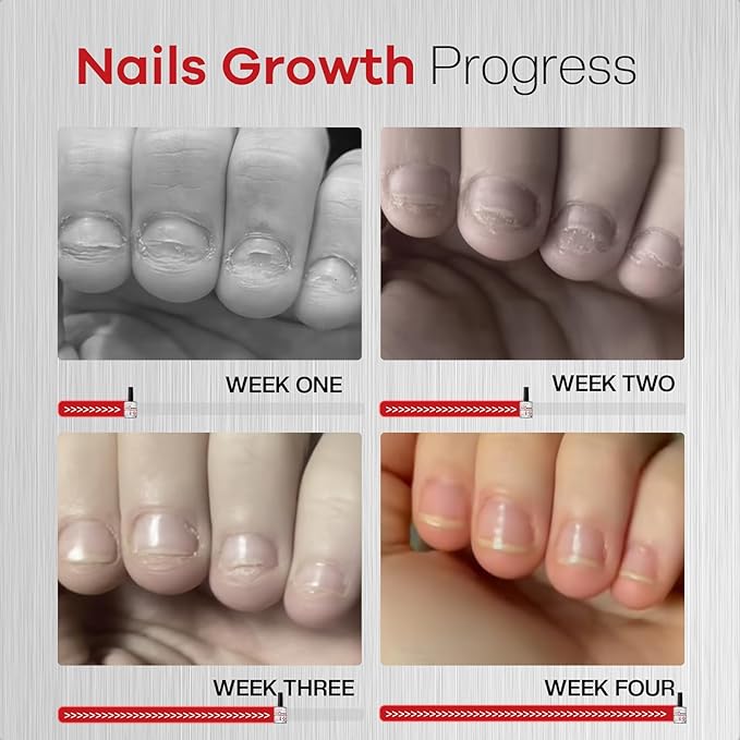 Nail Biting Prevention For Kids: 12ml Extra Bitter No Bite Nail Polish Thumb Sucking Deterrent 48H Long-Lasting Matte Clear Strength Nail Repair for Damaged Nails Care & Habit Breaker Aid