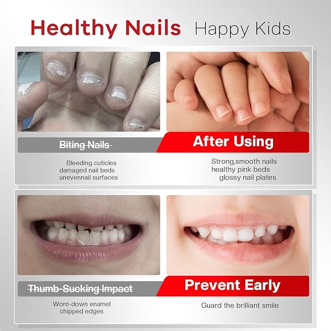 Nail Biting Prevention For Kids: 12ml Extra Bitter No Bite Nail Polish Thumb Sucking Deterrent 48H Long-Lasting Matte Clear Strength Nail Repair for Damaged Nails Care & Habit Breaker Aid